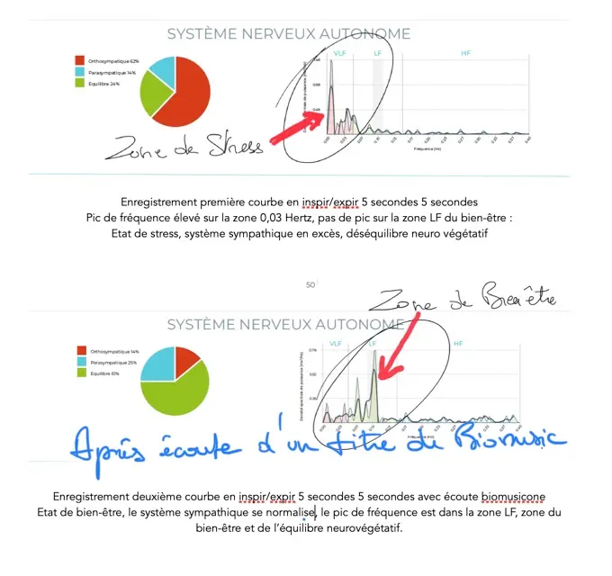 Heart coherence measurement with Bio Music One – visual 1