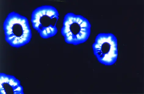 Electrophysionic test with Bio Music One