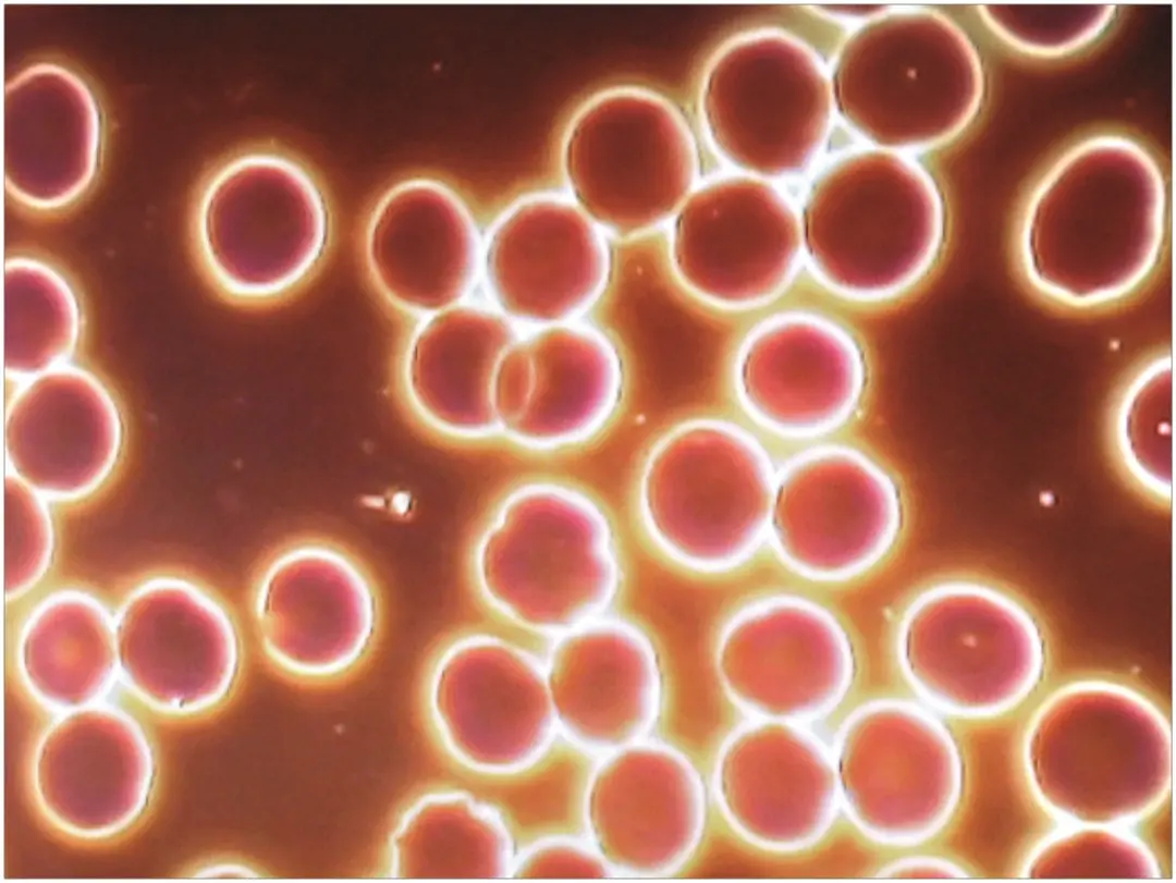 Human blood with Bio Music One