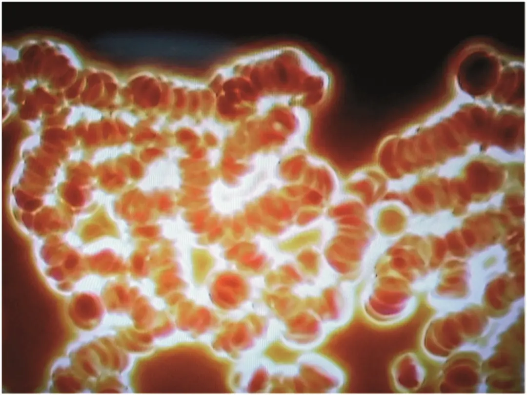 Human blood without Bio Music One